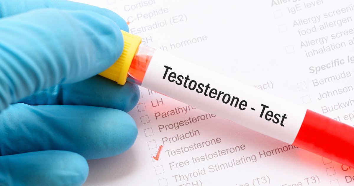 testosterone test