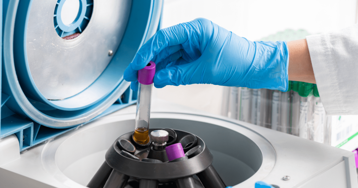 blood is put into the centrifuge