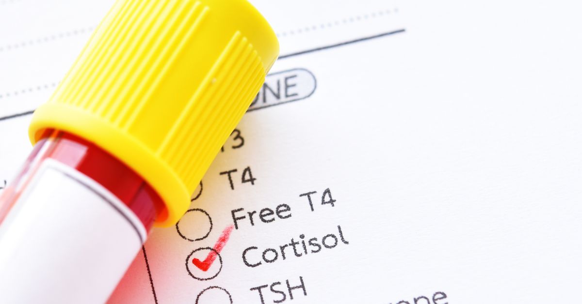 cortisol test